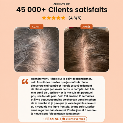 Capillys™ — avant après et avis en français